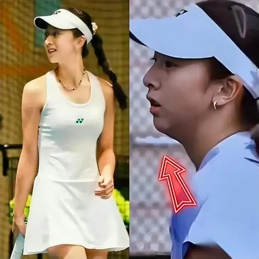 天呐！森碟下巴咋变长了？最近看她亮相网球场，原本后缩的下巴竟“逆袭”了，整个人颜