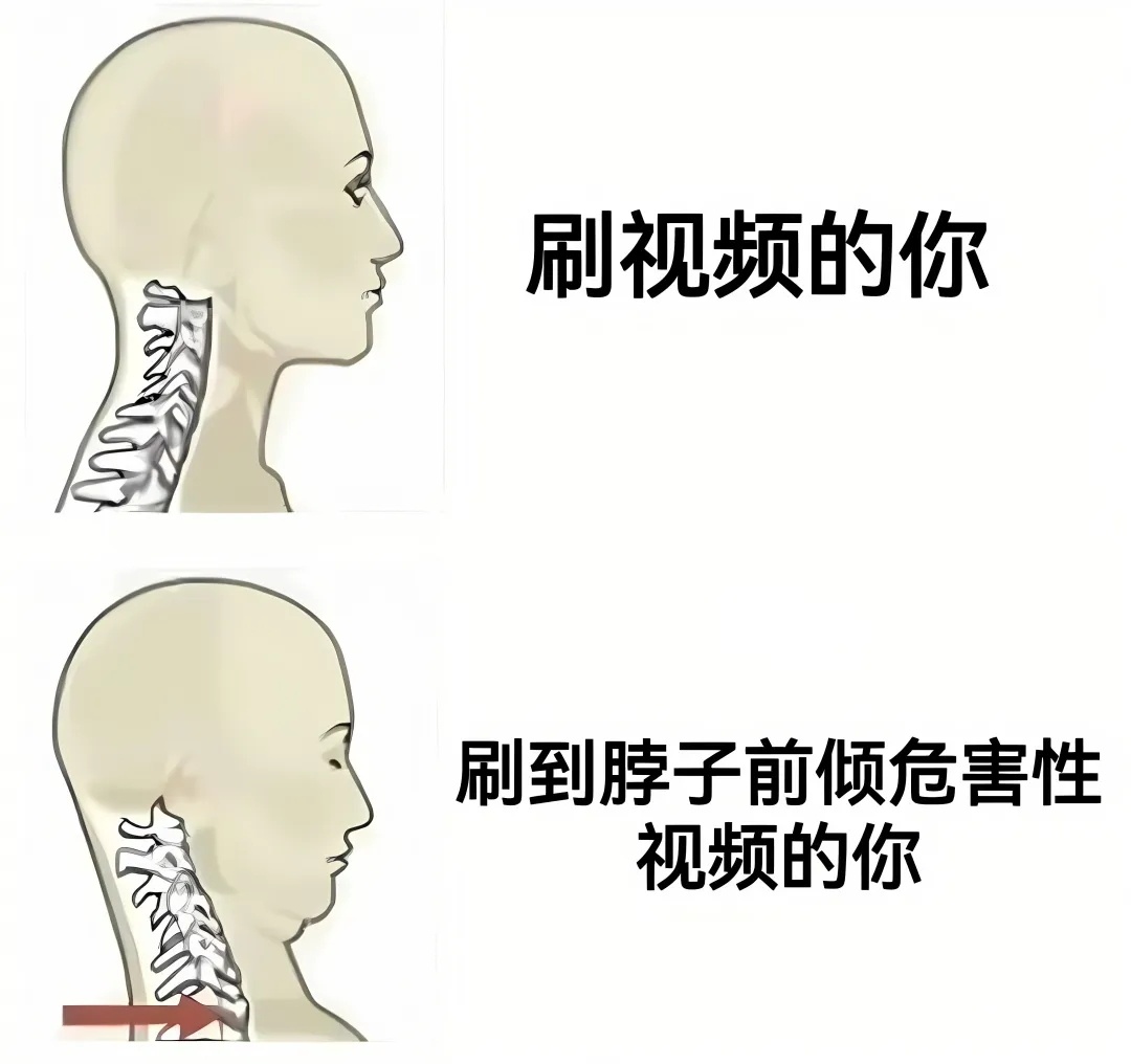 迅速坐直 meme  / 