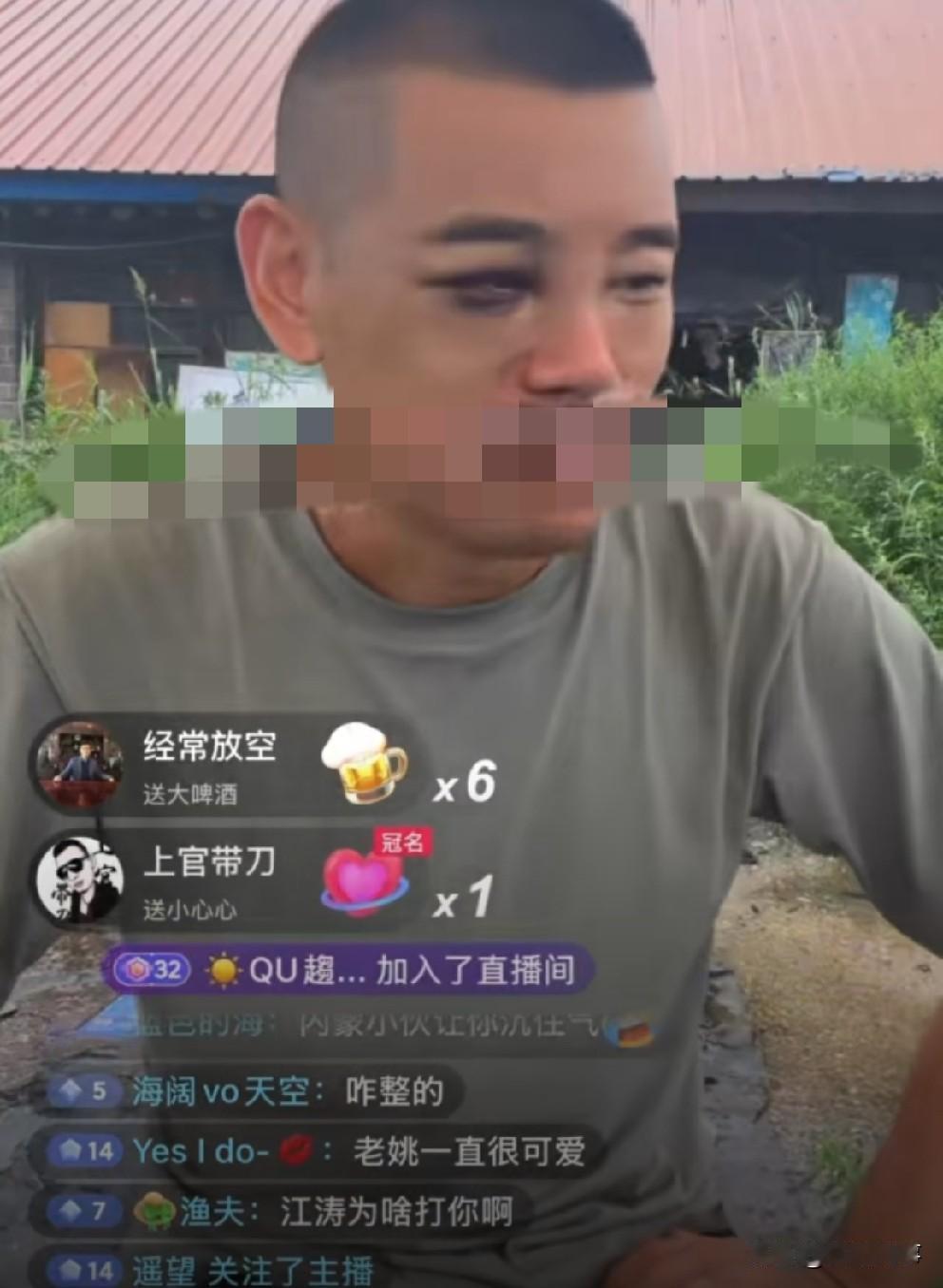 姚永纯“乌眼青”狼狈开播，破产患上严重抑郁躯体化！

         姚永纯去
