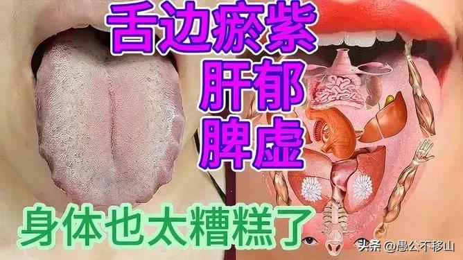 肝郁所致脾虚的调理

党参，白术，茯苓，炙甘草，陈皮，姜半夏，北柴胡，炒枳壳，白