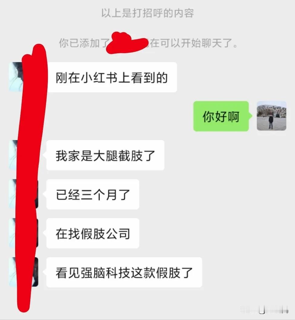 ​我之前发过一些人工智能假手的内容，也收到很多手指、大腿缺失的残疾人及家属，找来