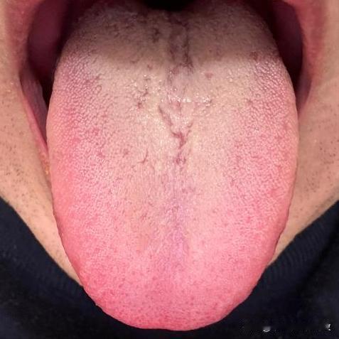 房事不佳，不建议用辅助药物逞能，最后只会适得其反[发怒][发怒]

这个大兄弟前