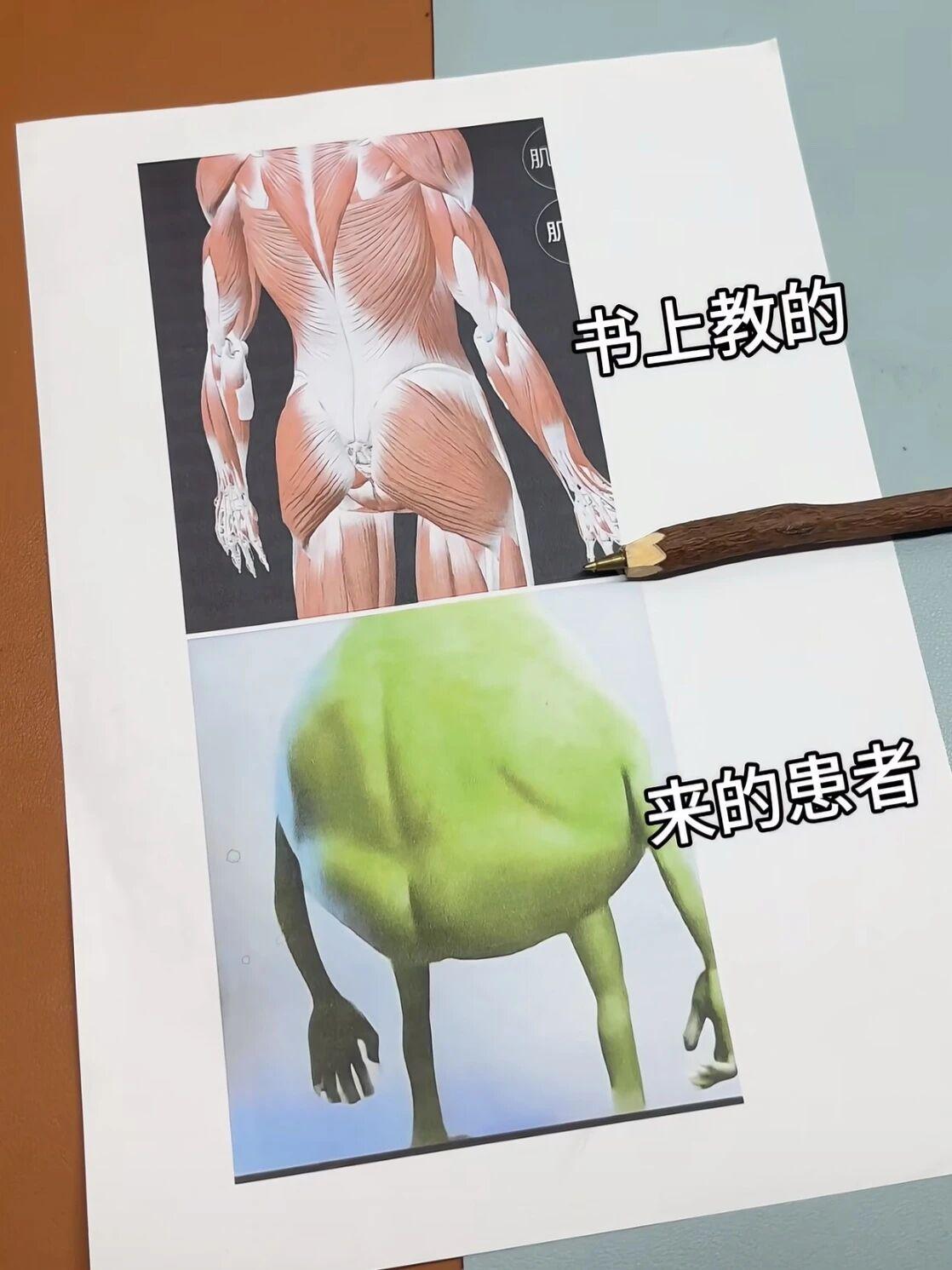 有没有学医的朋友告诉我，这是真的吗？