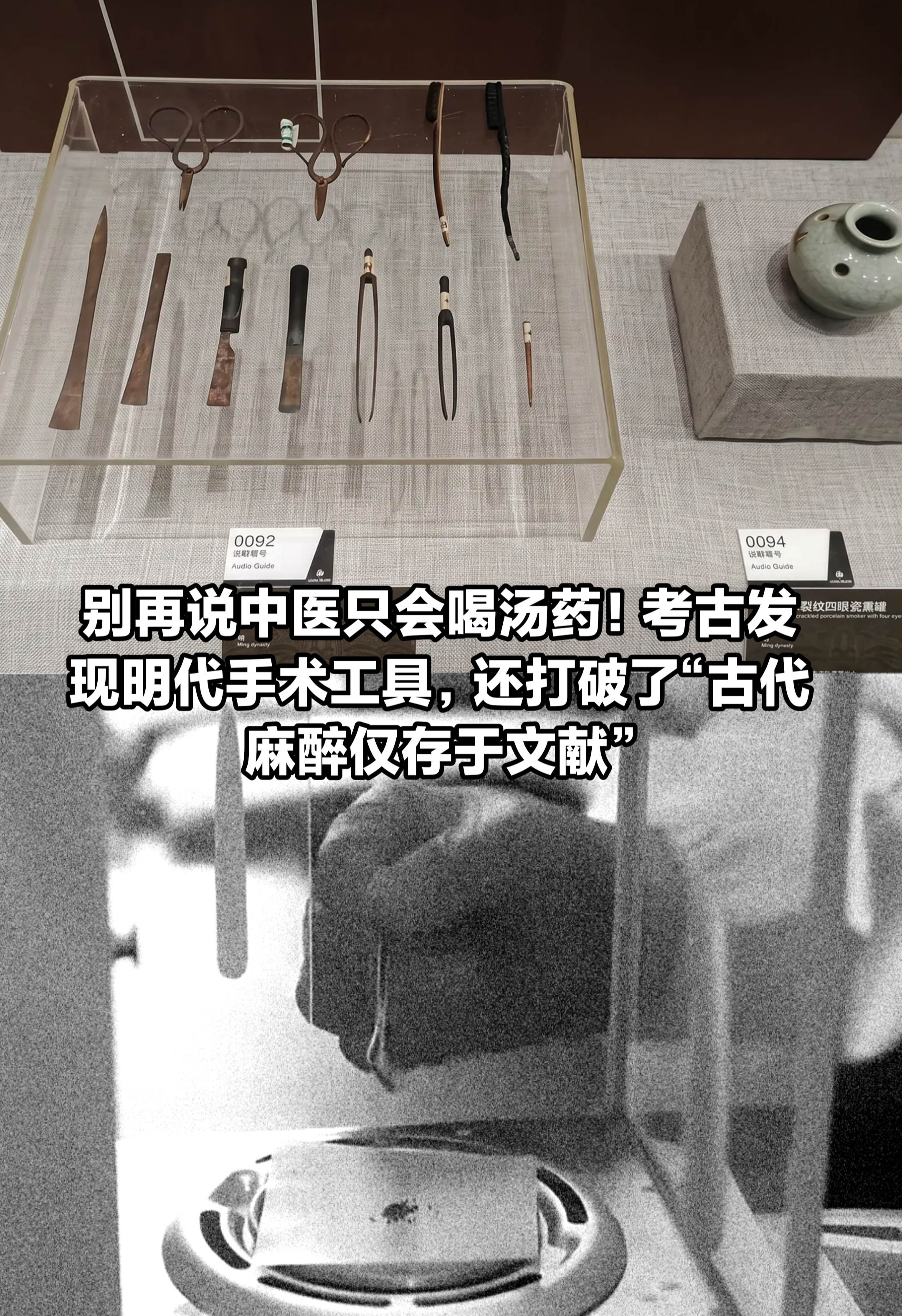 考古发现古代中医的多元广博。