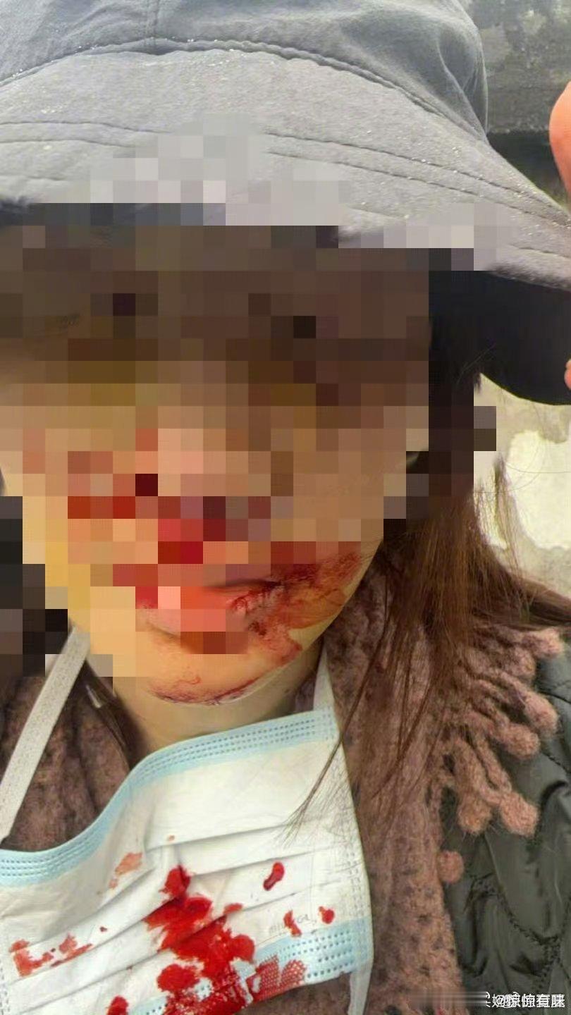 金晨伤的好重容貌对女艺人而言本就是被过度关注的焦点，远比普通人承受更多审视，金晨