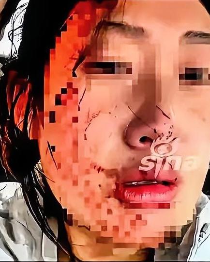 【6岁娃输液扎针哭闹，父亲两拳把护士打成重伤！网友炸了：这是护娃还是害娃？】
