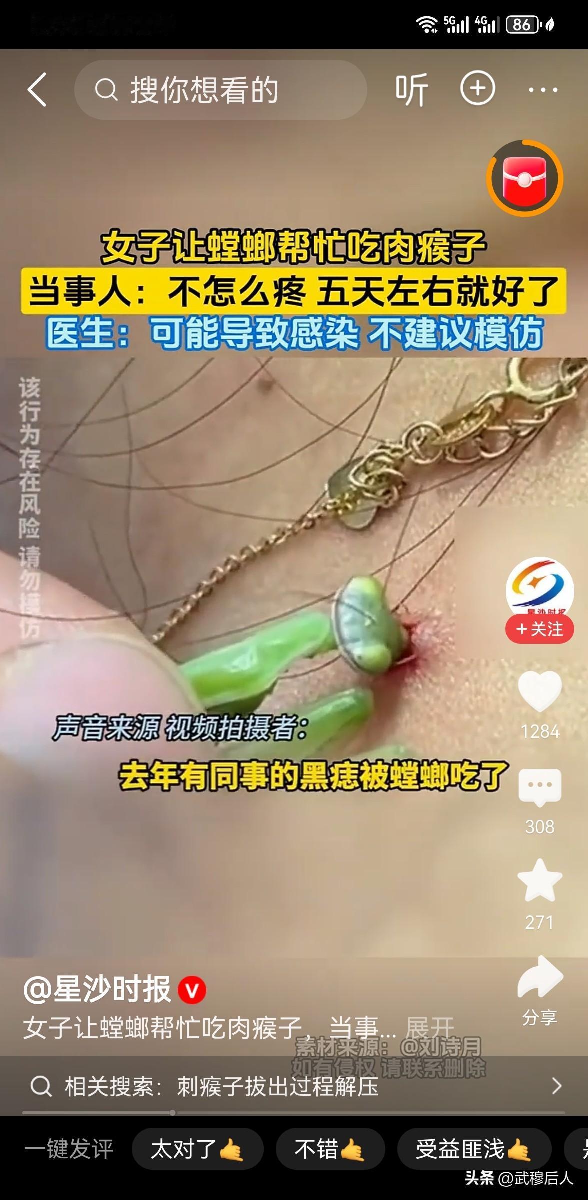 女子让螳螂帮忙吃肉瘊子
 
生活中不少人身上会长肉瘊子，虽说不影响健康，但看着刺