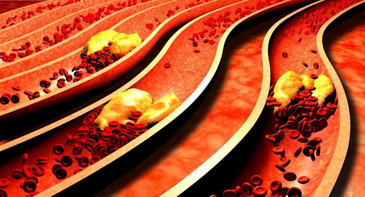 很多人好奇，为什么阿司匹林的不良反应最大，却又最常用呢？这是因为阿司匹林的抗血小