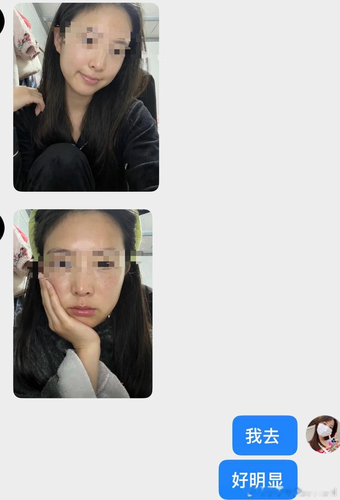 哈哈哈哈还没开始卖 都有很多人之前用过要来买的了用之前 一定先拍张照片  我挂预