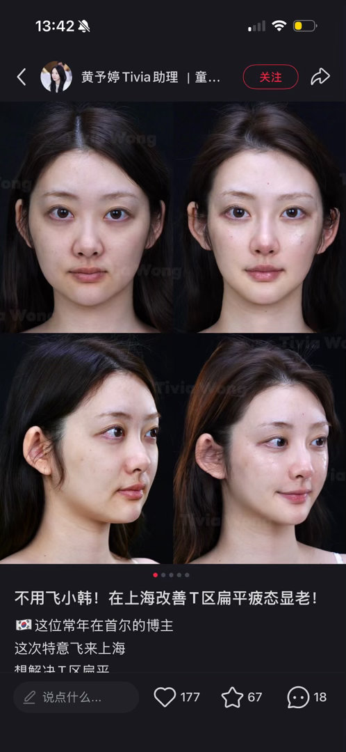 眼球不凸的，一点也不像怪物 ​​​