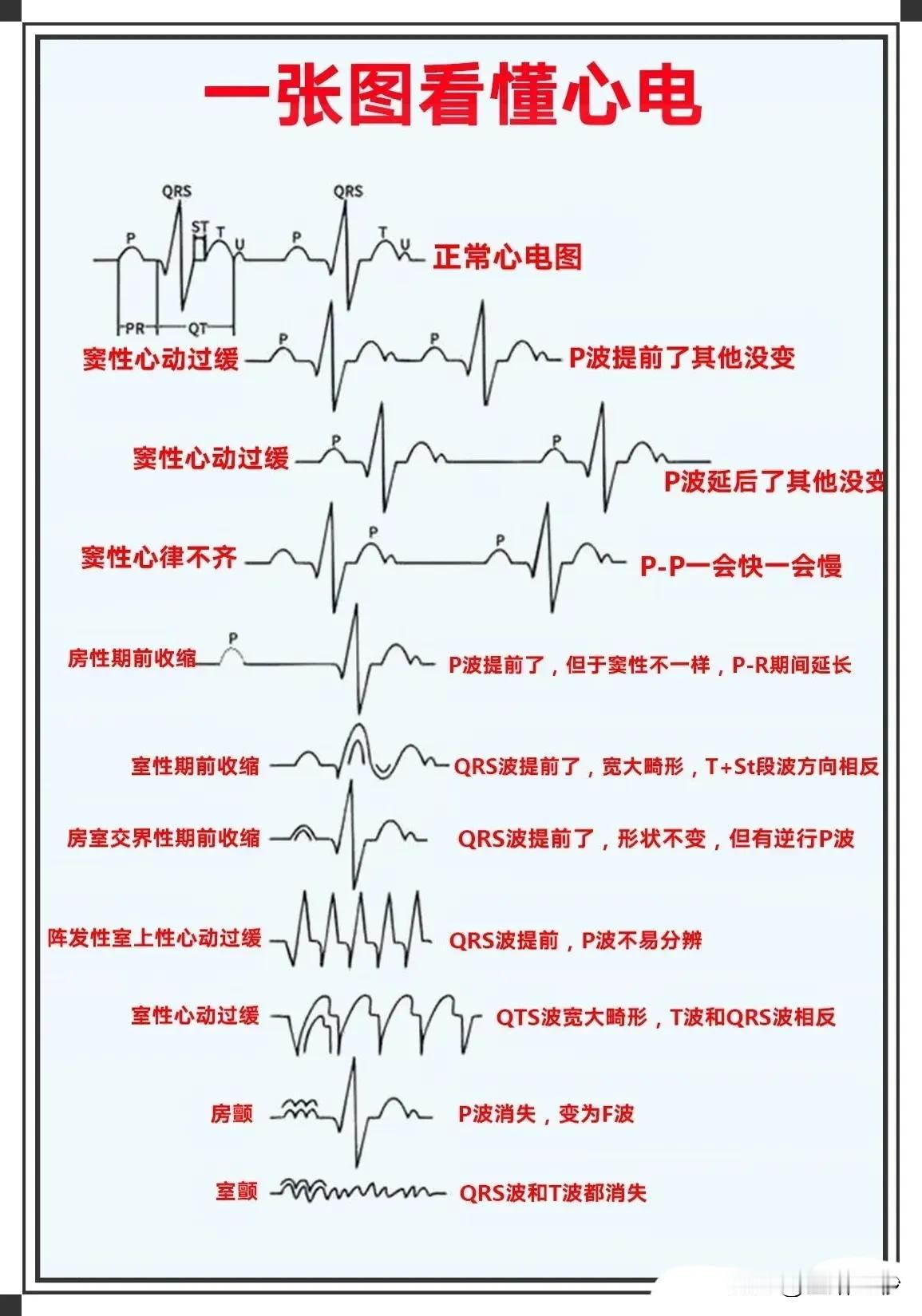 你知道吗？心电图是心脏健康的“晴雨表”。但复杂的波形常常让人一头雾水。今天，我们