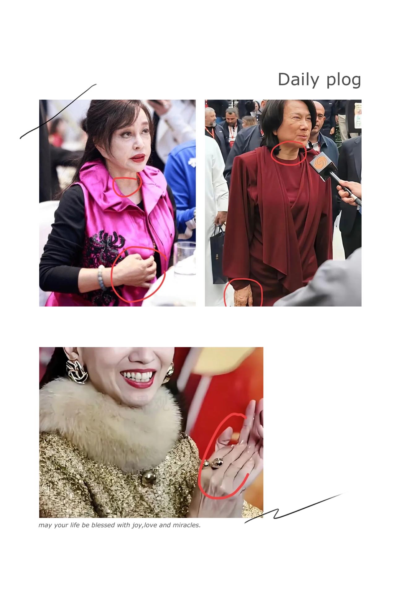 女人的年纪，果然藏不住手和颈纹里！董明珠、刘晓庆、赵雅芝在聚光灯下靠美容针、滤镜