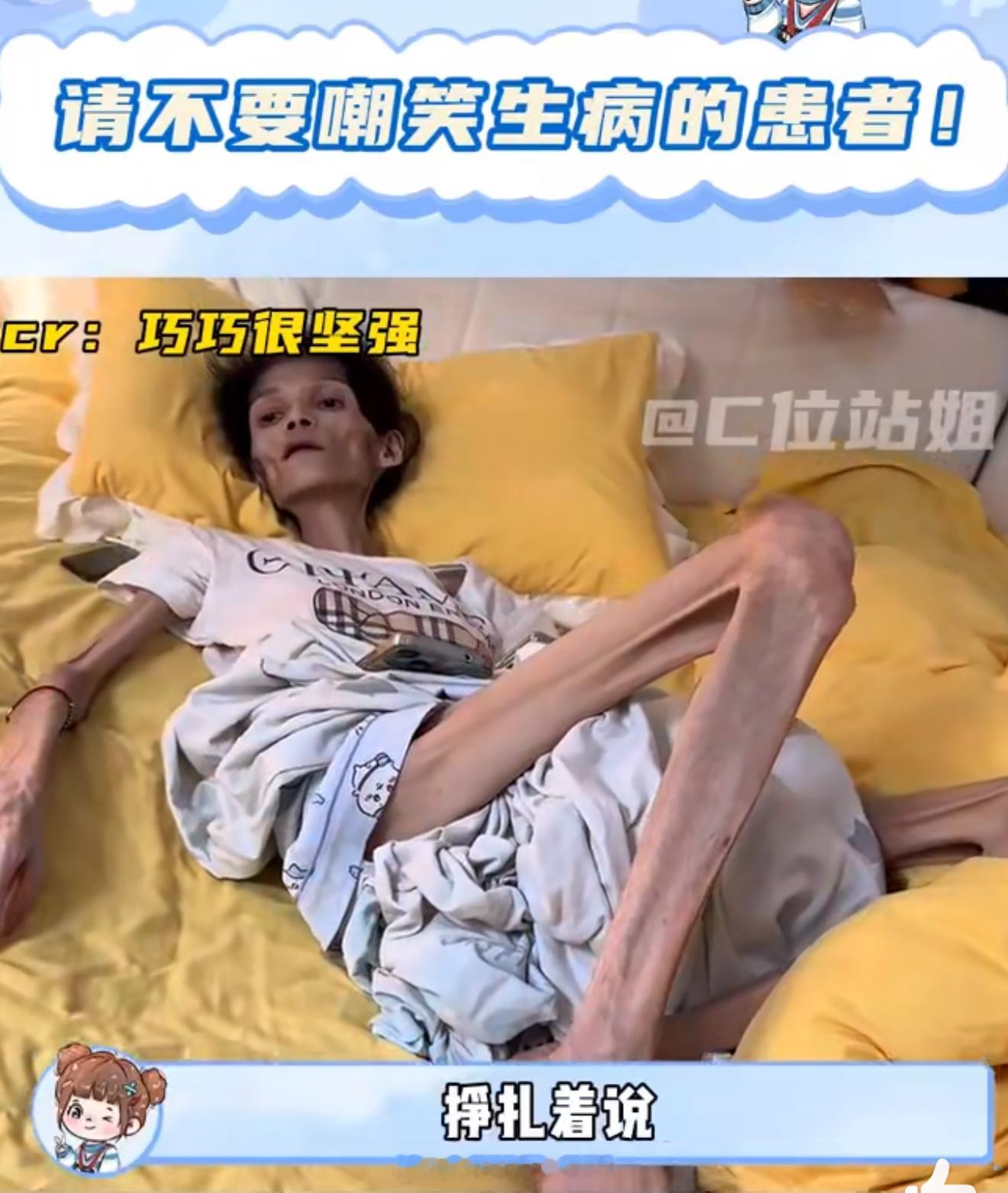 体重仅35斤女生发视频求助不是…到底谁在嘲笑别人患者呀[流汗]没想到是遗传病[跪