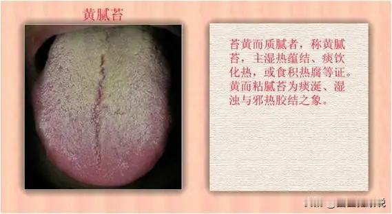 湿热太重是会口干的，喝水也解决不了
你起床后或熬夜后，会有口干口苦的情况，有的人