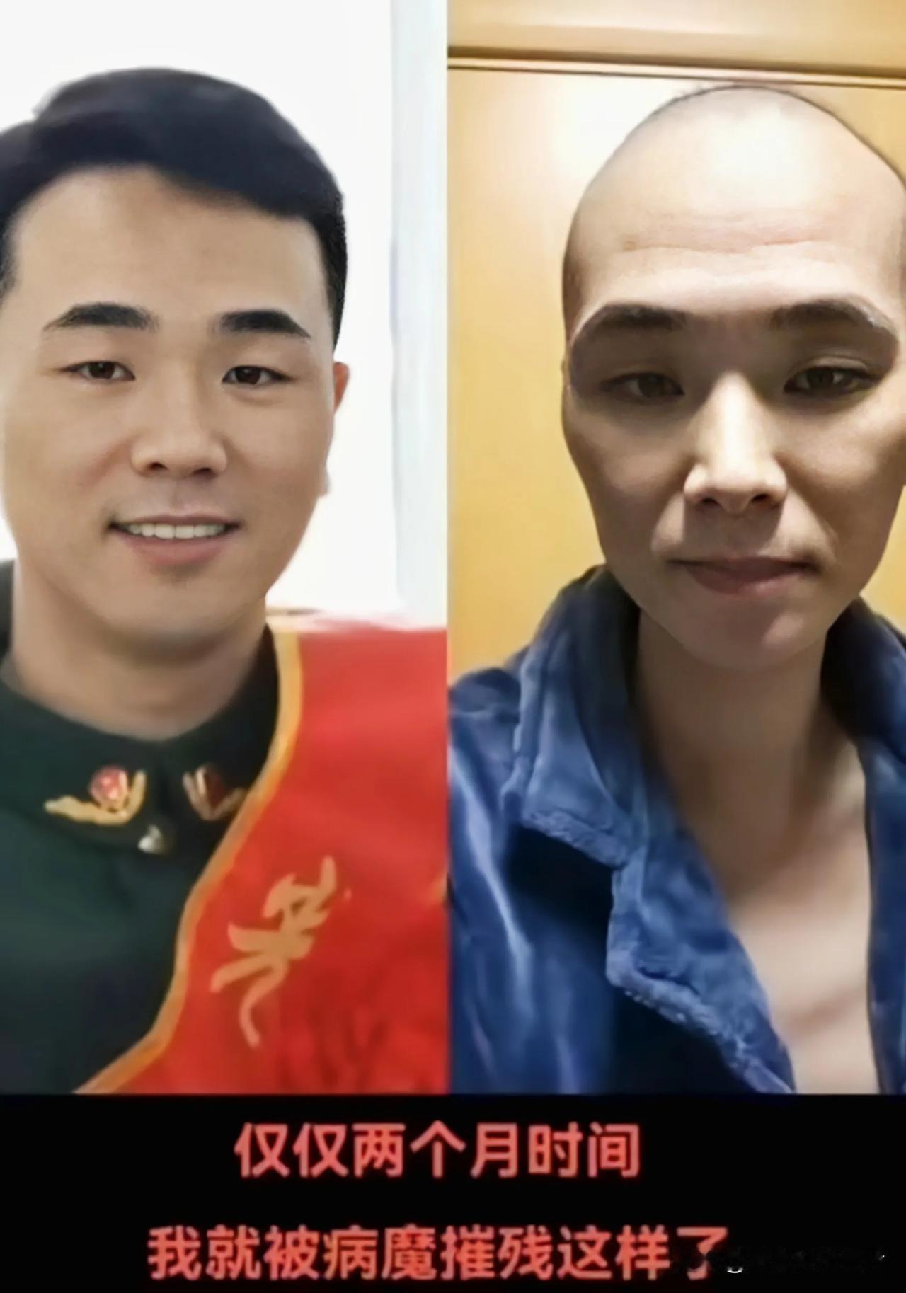 当兵16年的武警退役士兵陈伟，两年前查出淋巴癌晚期，年仅36岁的他，还是没有躲过