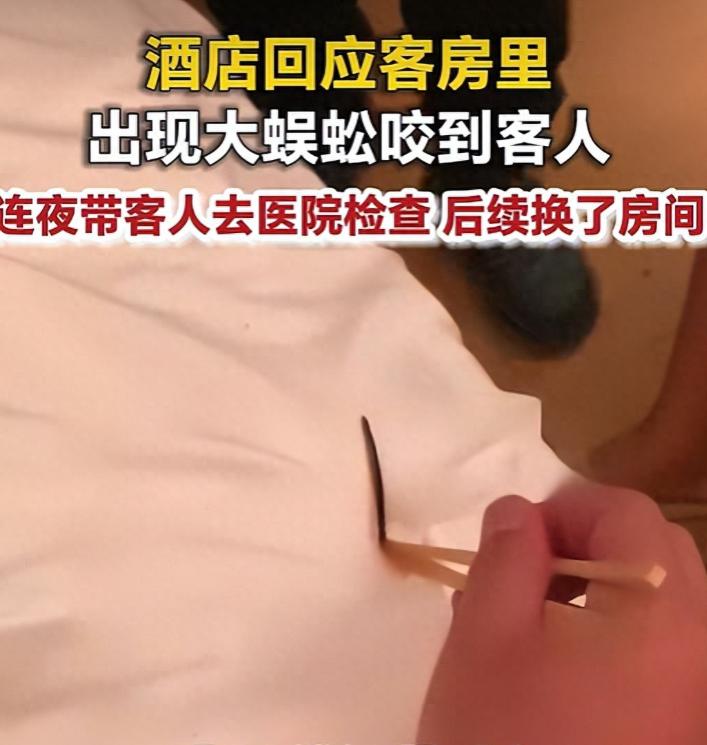 北京一名网友外出住酒店，待在客房里面，冷不丁被一条大蜈蚣给咬伤。被咬之后皮肤刺痛