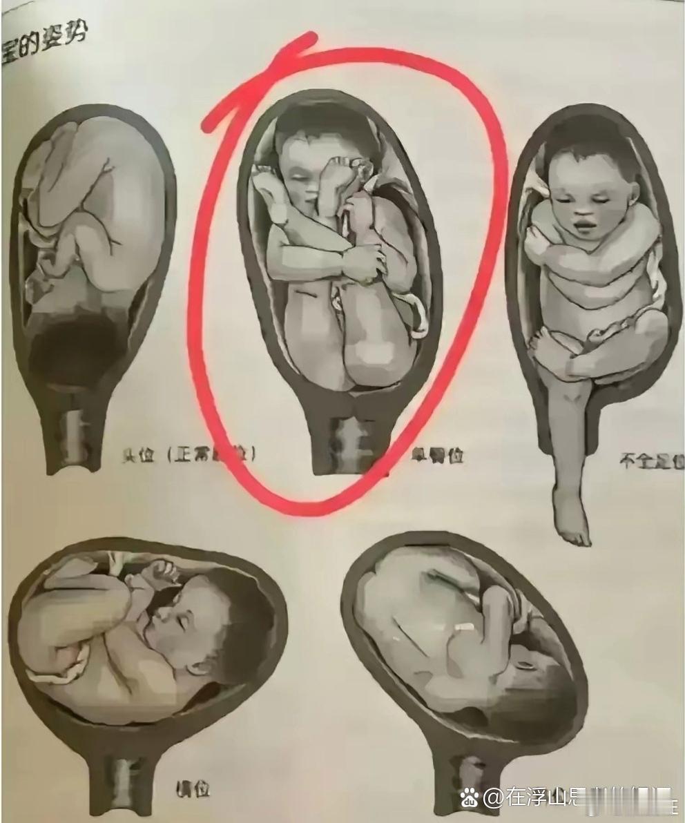 图二胎位放古代，九死一生吧？ 