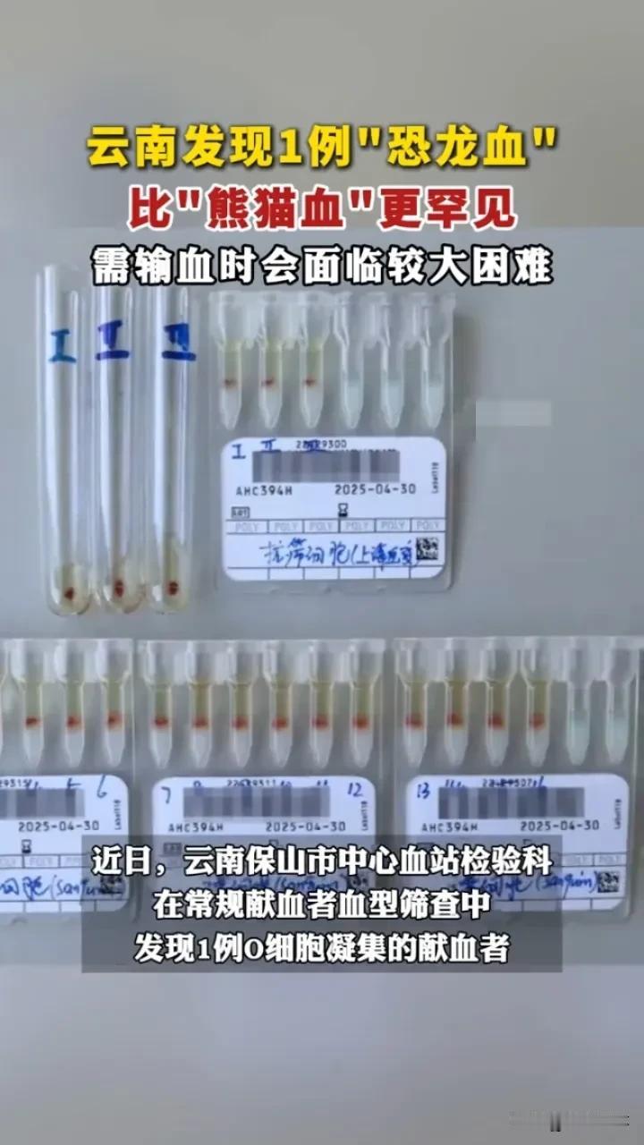 罕见“恐龙血”：机遇与隐忧并存
 
云南惊现的“恐龙血”，比熊猫血更稀缺，瞬间聚