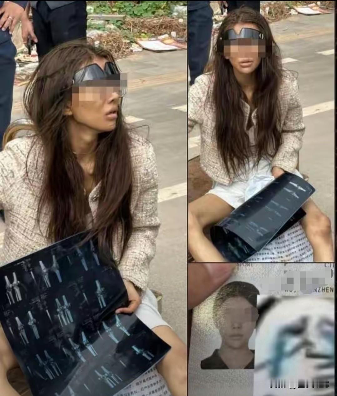 网红美女被“高薪”诱骗到柬埔寨流浪街头，浑身脏兮兮，身上还有伤，乞丐似的真惨，和