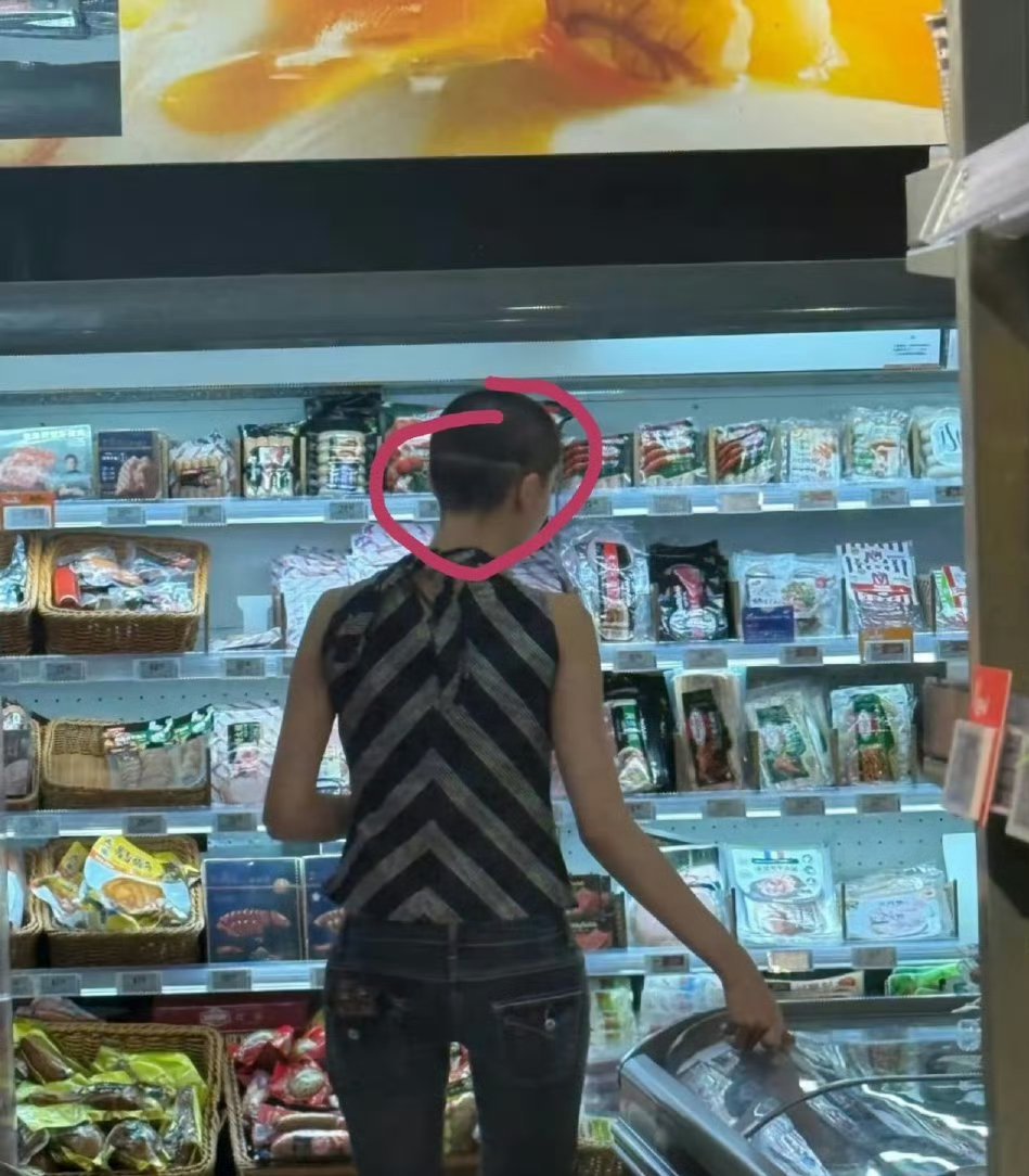 金子涵手臂婧妹金子涵怎么了看得我起了一身鸡皮疙瘩.....爱美丽的小姑娘，后来退