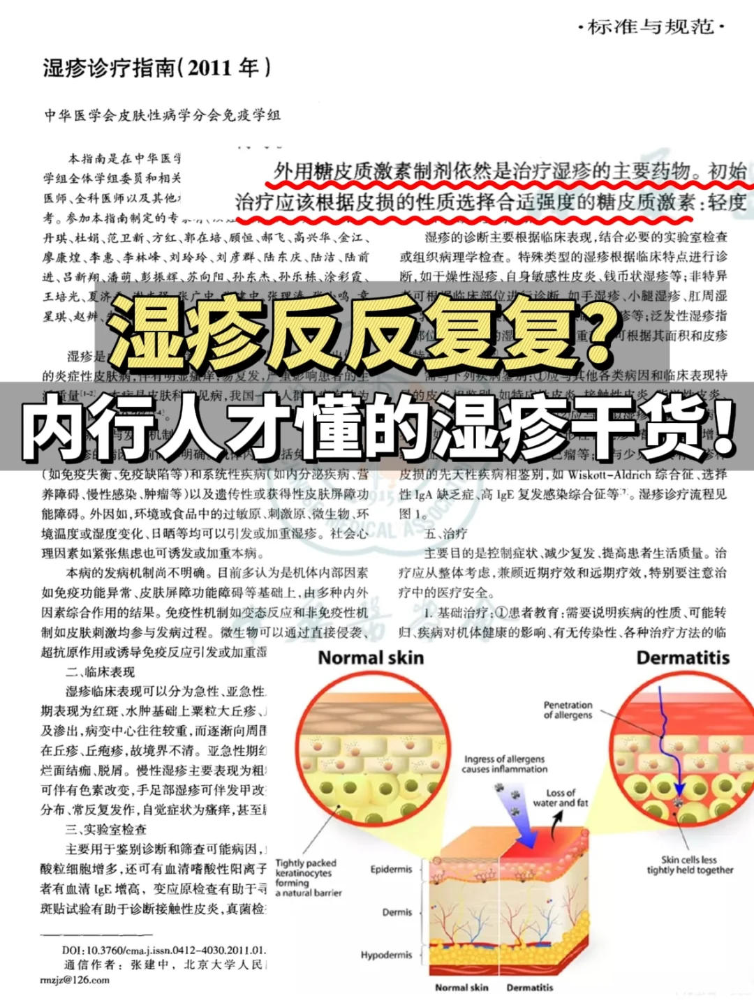 内行人才懂的湿疹干货！一招对抗红疹瘙痒