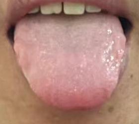 宗筋状态欠佳，未必单纯是亏虚！气血不畅、瘀滞阻滞，循序渐进调养助力宗筋恢复

