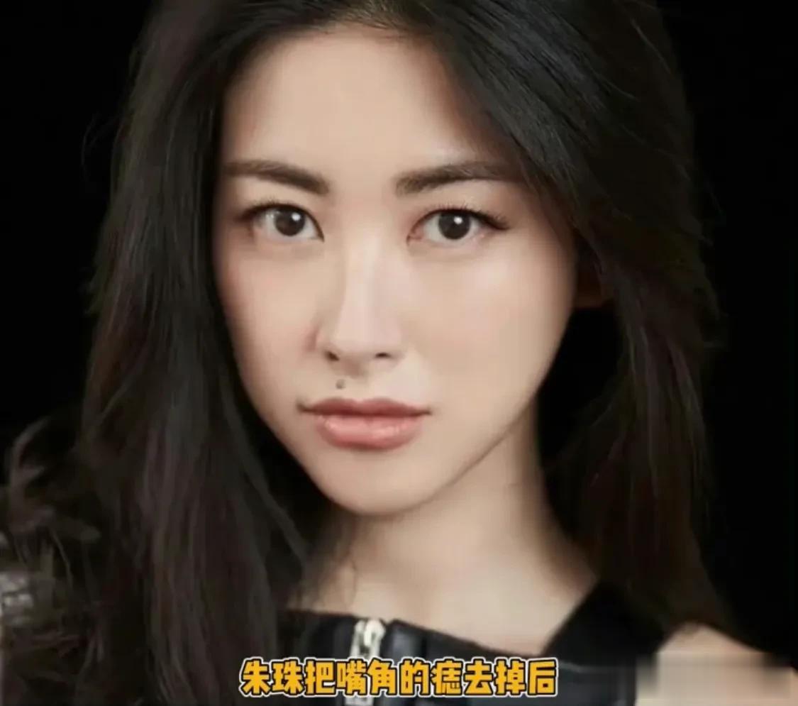 痣长的好了是标志，长的不好影响颜值，朱珠嘴角的痣去掉后，整个颜值都提升了一个等级