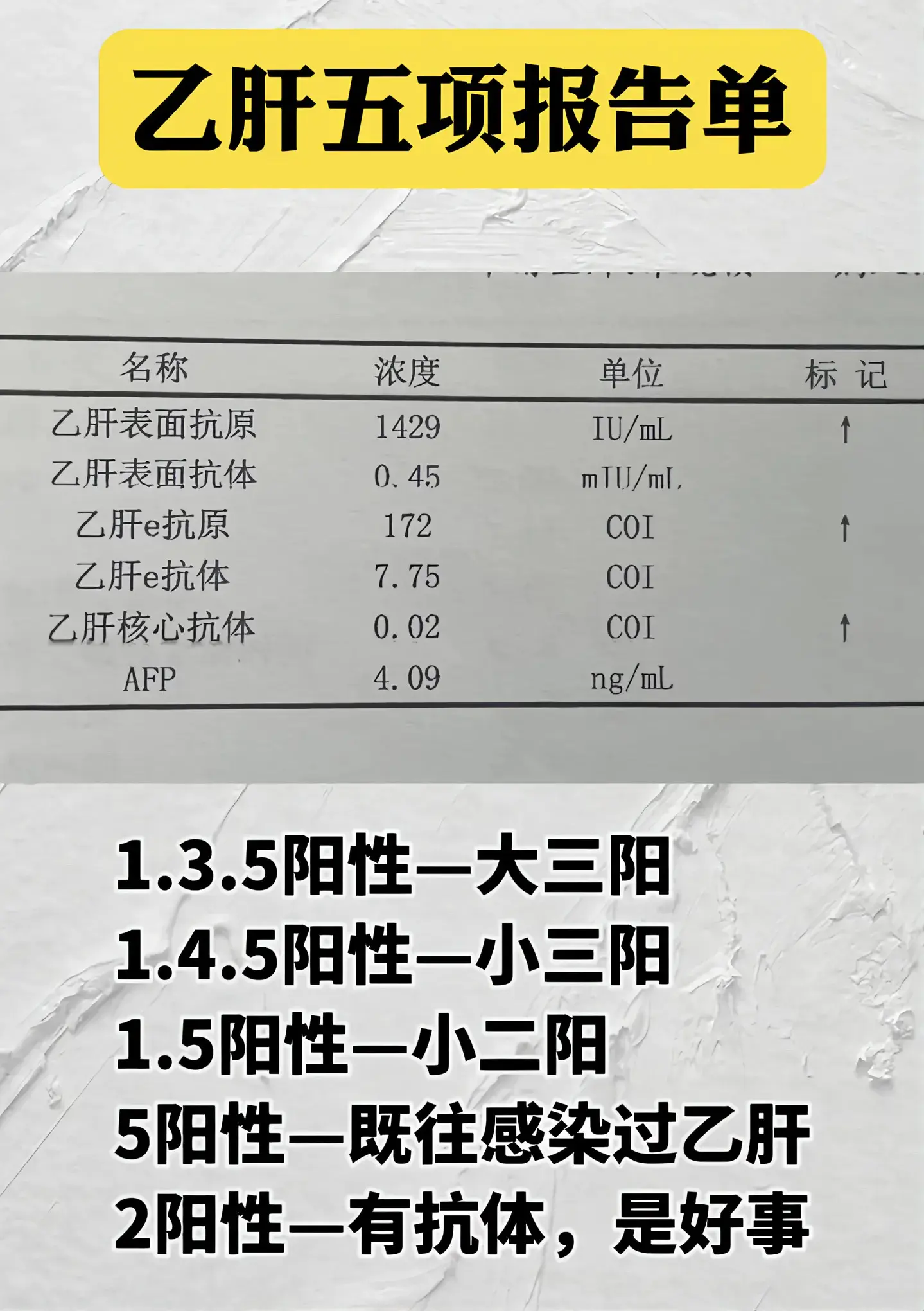 肝脏 乙肝五项 肝硬化 医学科普 山东