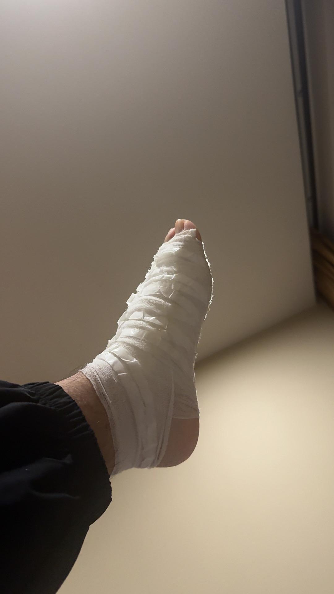 全肿。为什么🧐。什么毛病