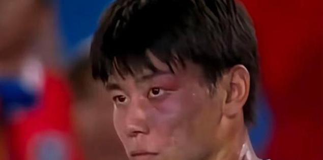 19岁青面兽庞智超：从小就是学霸，为练球不治胎记，已被武体录取。19岁少年庞智超