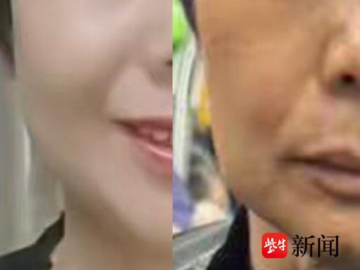 浙江金华61岁雷女士养老钱被坑，微商中间人专盯中老年妇女，几百万养老积蓄直接被套