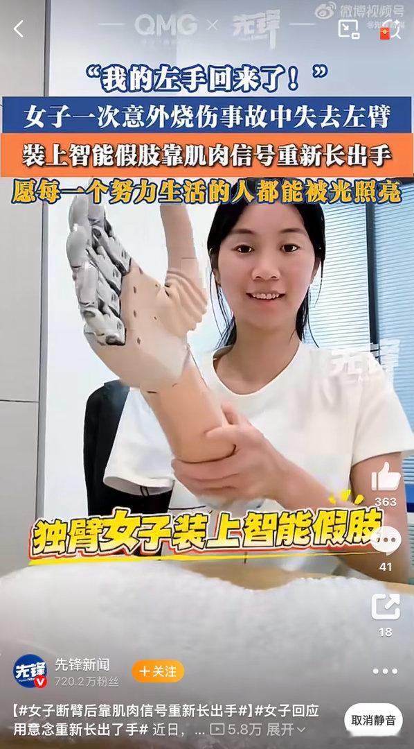 女子断臂后靠肌肉信号重新长出手 晕，重新长出手！还以为是医学奇迹，原来是标题党