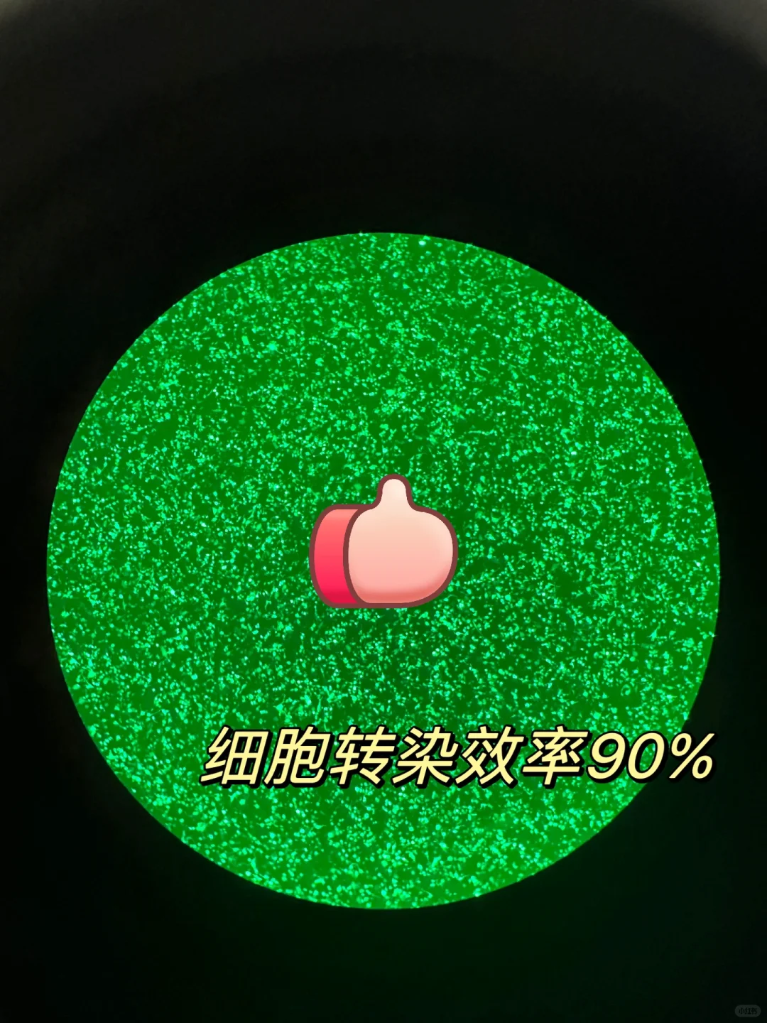 细胞转染…满满的全是荧光🙌🏻