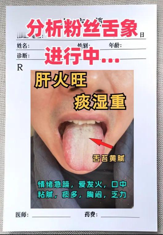 免费舌诊——这个月每日坚持抽空看舌象第22天！

在线收集88个舌象，你发舌头照