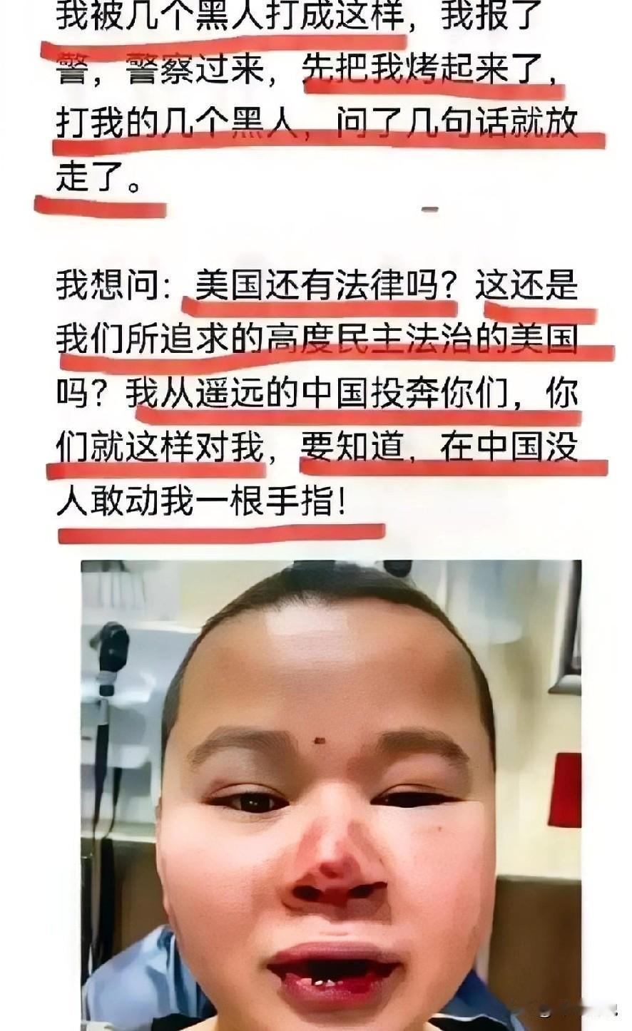 今天看到一个在美国的润人哭诉的视频，原因是他在大街上被人给打了，于是乎他哭诉着说