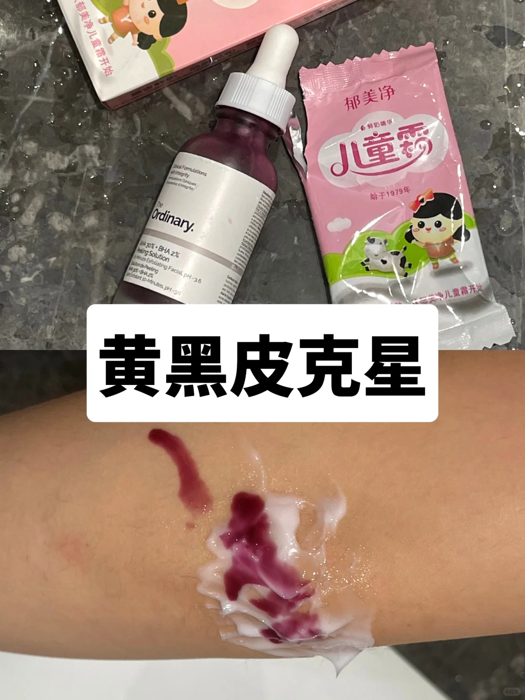 重度黄黑皮！频繁使用果酸的代价是……