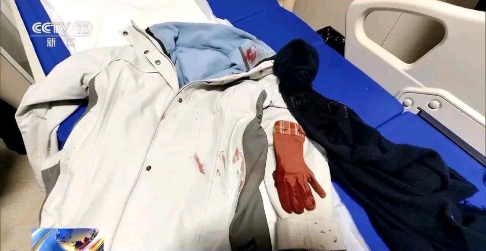 女警徒手夺刀，脸上缝30多针：“后怕但不后悔”在那惊心动魄的夺刀瞬间，女警凭借着