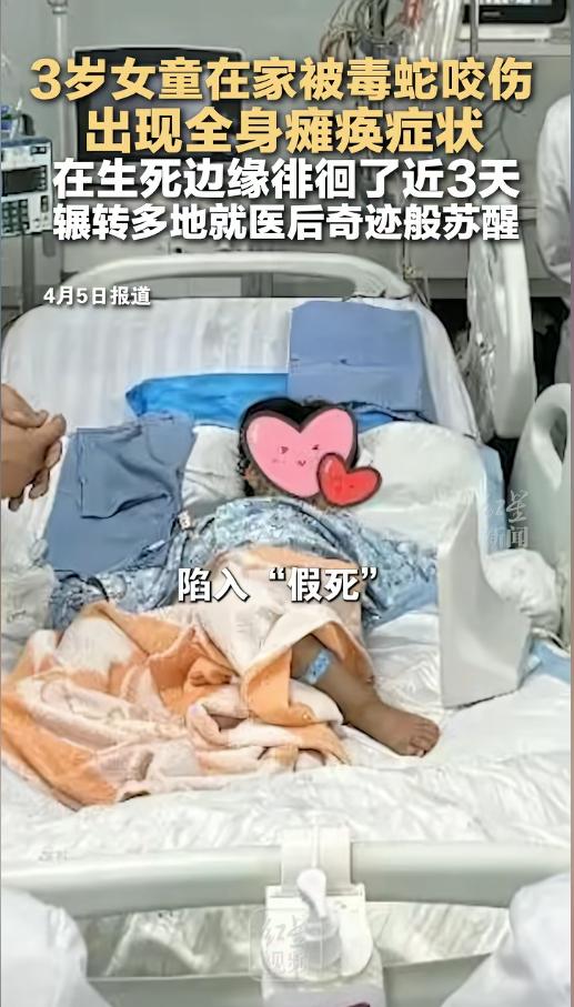 “命真大啊！”3月27日，云南文山，在家中不慎被毒蛇咬伤，等送到医院时，就已经出