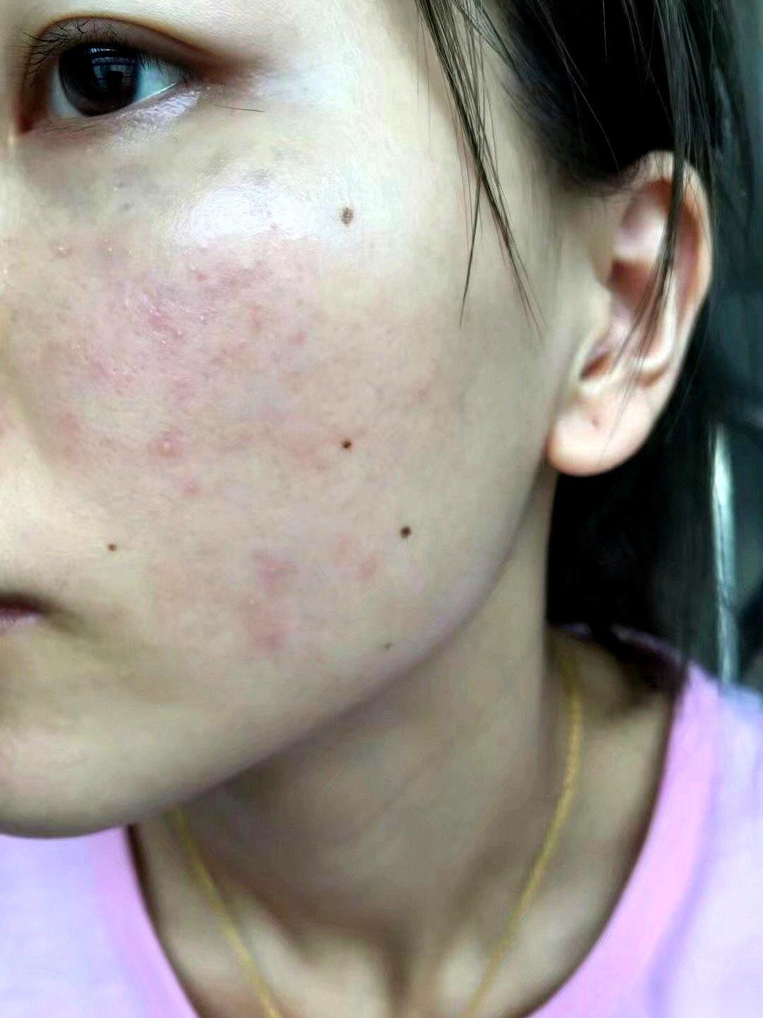 周三、周五。
就这两天，一个老中医，藏在个小诊所里。
这消息，是一个在医院走廊里