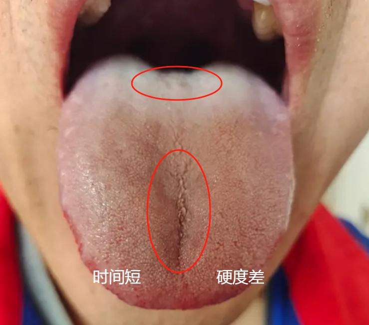 男人能力不佳，续航时间短？出现这样的舌头，千万不要吃六味地黄丸！

这是一位粉丝