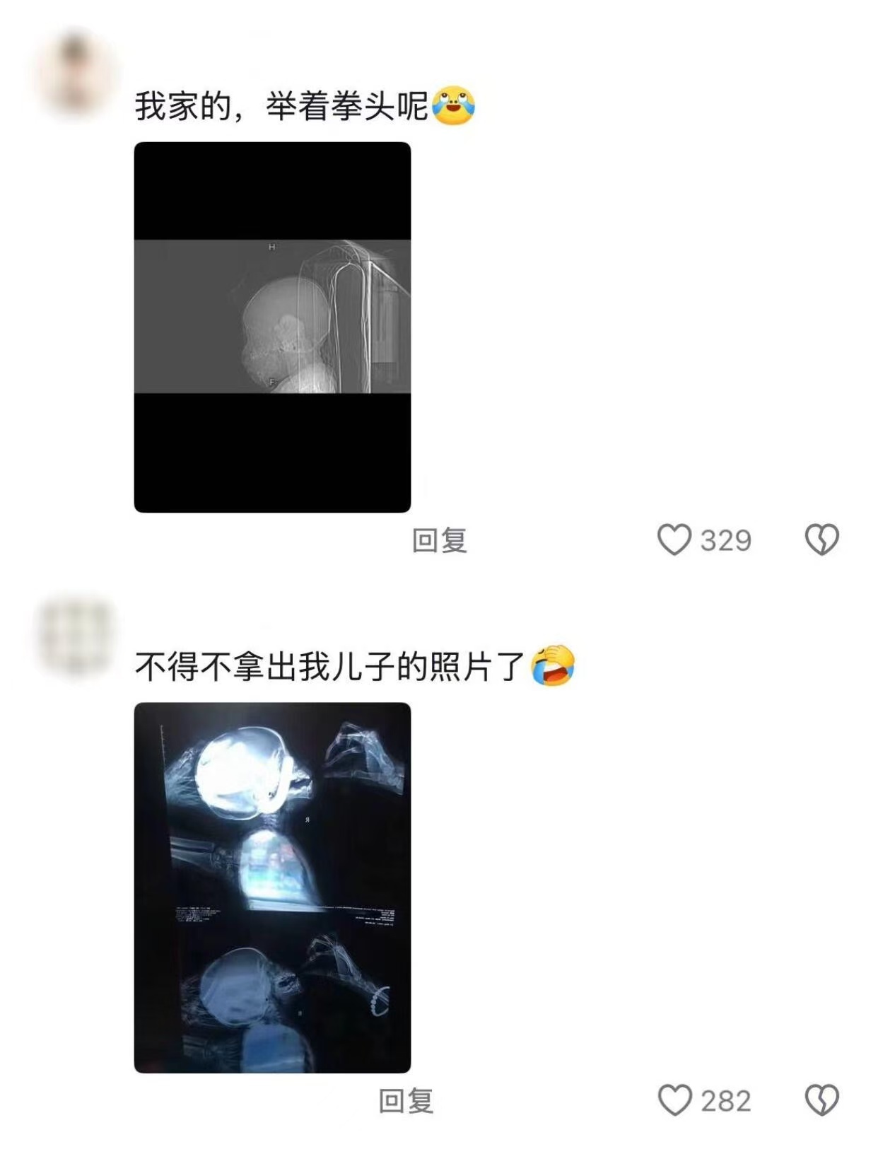 影像科的医生是怎么忍住不笑的啊 