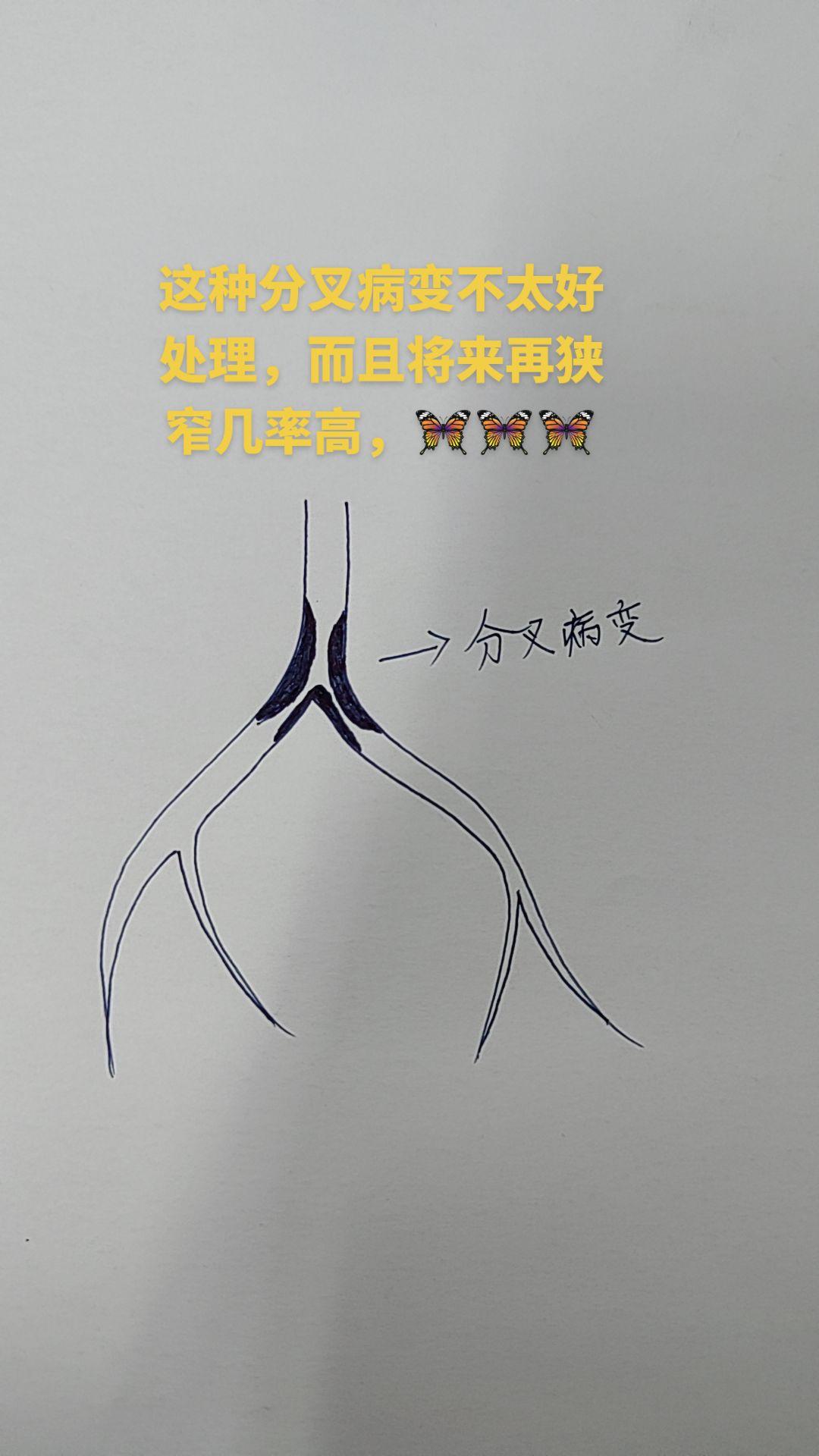 关注我每天坚持分享知识 医学科普 医路前行 每天坚持一点点 主打的就是一个真实