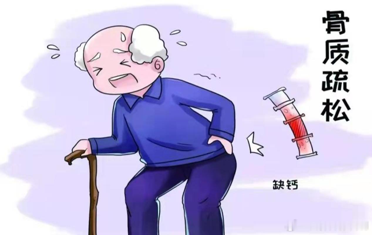 #这个问题吃什么# 【骨质疏松有 3 大“典型症状”】1、腰背部疼痛。很多人可能