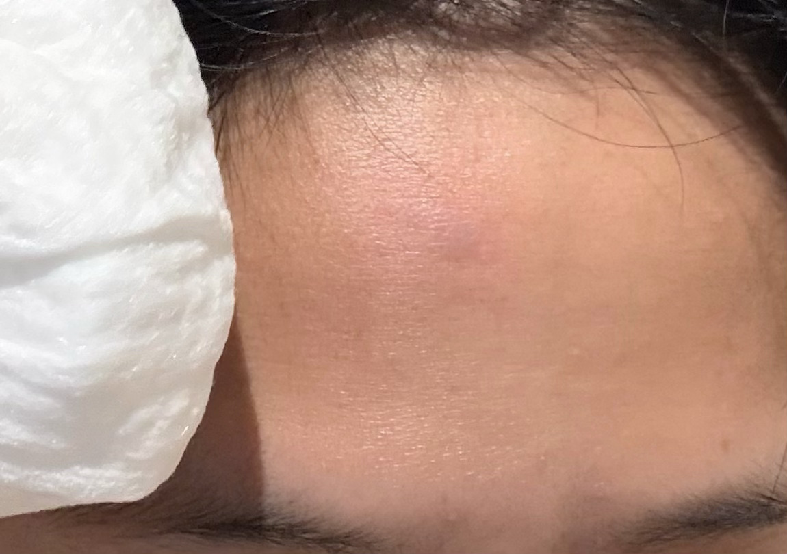 直板夹你完了 