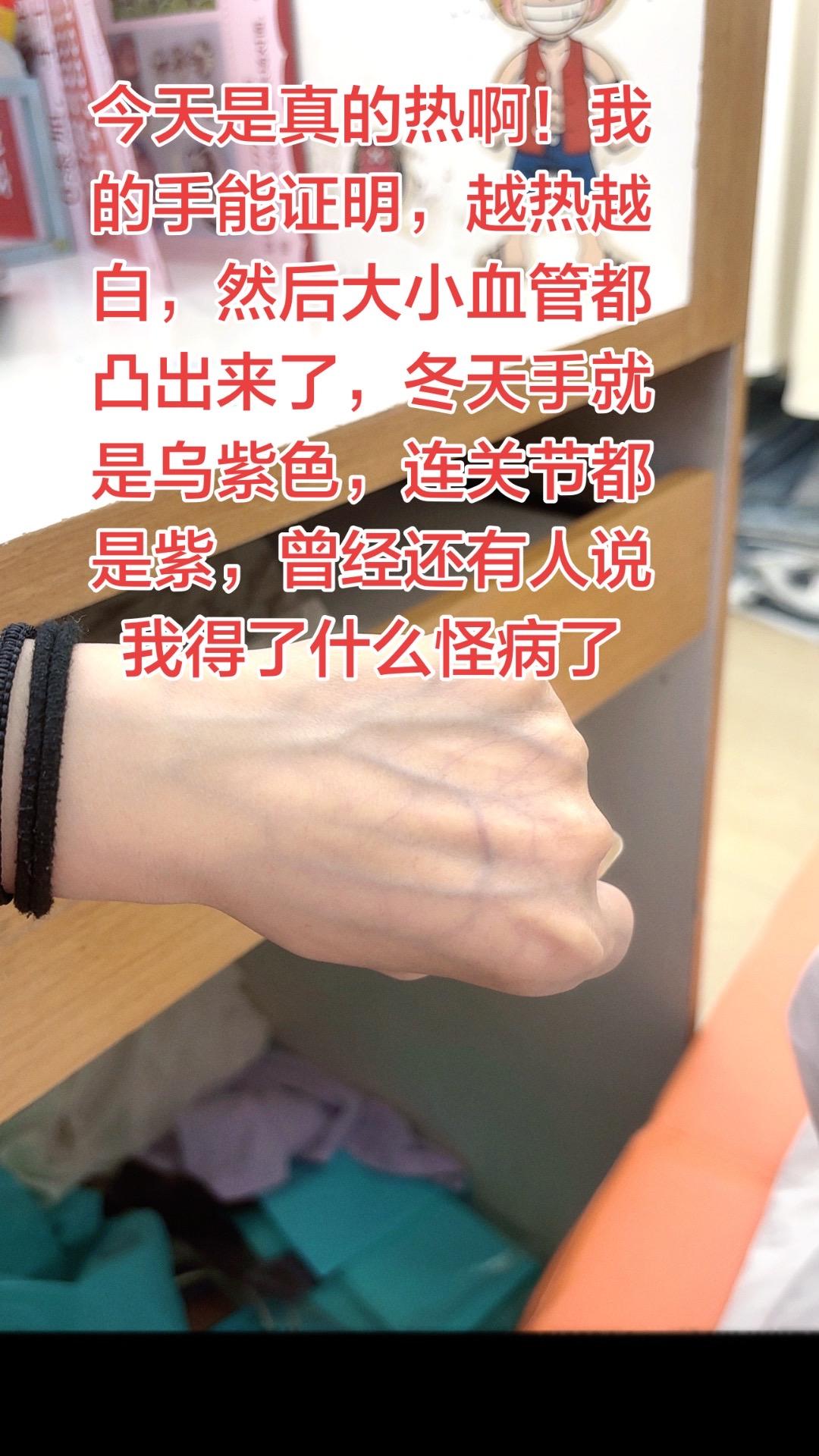 今天是真的热啊