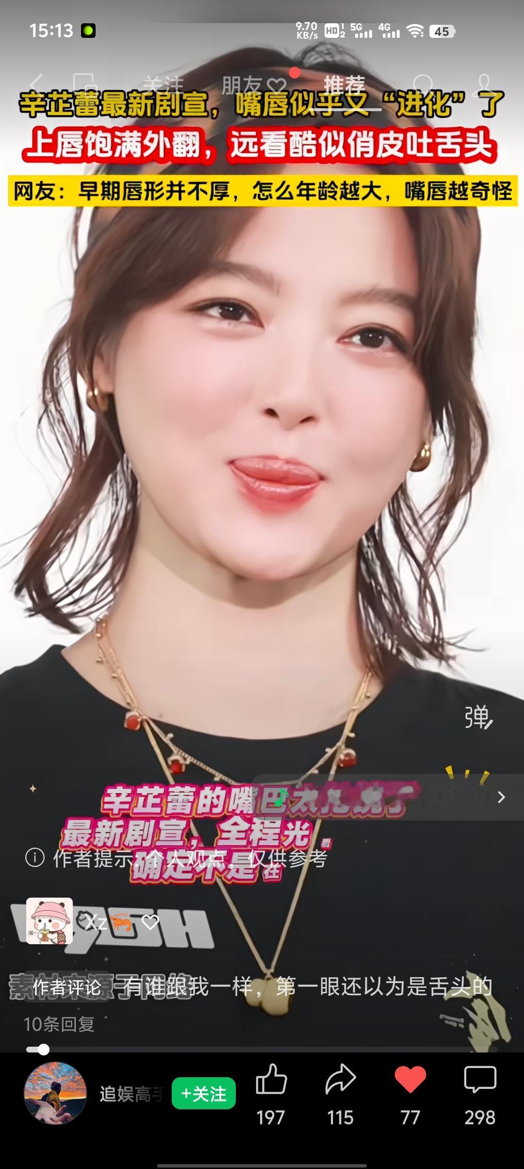 辛芷蕾最新剧宣活动画面曝光，不少网友第一眼就被她的唇部状态吸引。
画面里她上唇饱