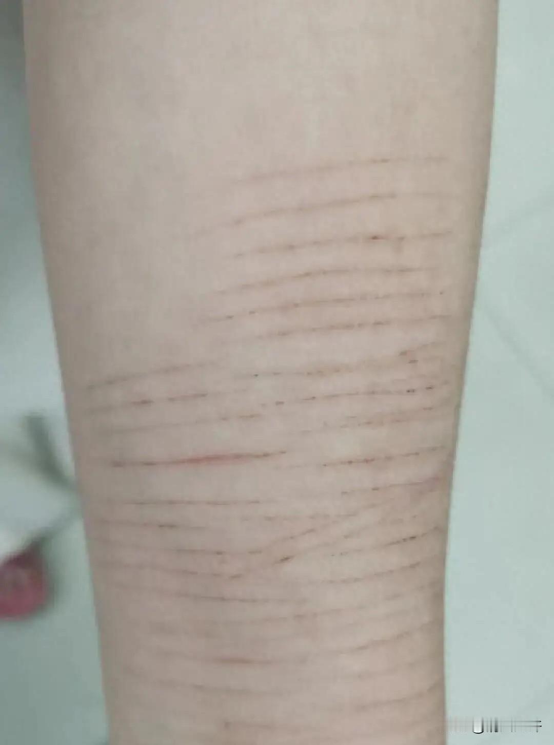 郑州一所中学的课堂上，14岁女生上课期间总是下意识地捂住胳膊，坐姿拘谨，眼神躲闪