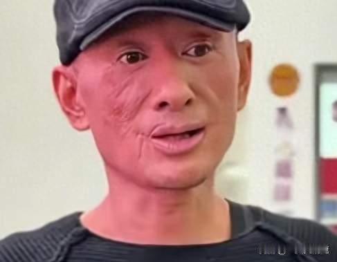 曾央视春晚献唱，人民大会堂开个唱！现面对脸部疑“被烧伤”自嘲