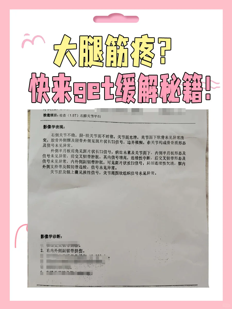 大腿筋疼怎么治疗最快最有效