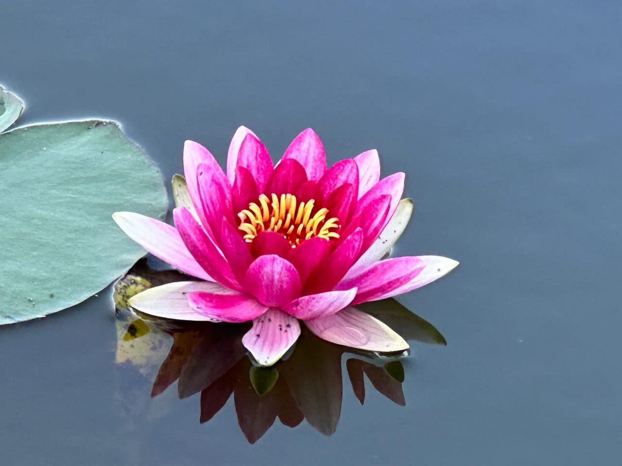 “姐，你不是退休了吗？你每个月的退休养老金有多少？”一名年轻小护士笑嘻嘻地凑到我